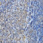 ARPC2 Antibody in Immunohistochemistry (Paraffin) (IHC (P))