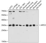 ARPC2 Antibody in Western Blot (WB)