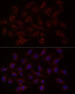 NTF4 Antibody in Immunocytochemistry (ICC/IF)