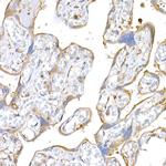 MAGED1 Antibody in Immunohistochemistry (Paraffin) (IHC (P))