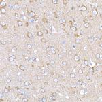 MAGED1 Antibody in Immunohistochemistry (Paraffin) (IHC (P))