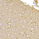 MAGED1 Antibody in Immunohistochemistry (Paraffin) (IHC (P))