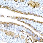 MAGED1 Antibody in Immunohistochemistry (Paraffin) (IHC (P))