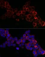 GPX1 Antibody in Immunocytochemistry (ICC/IF)