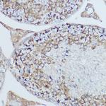 MTCO2 Antibody in Immunohistochemistry (Paraffin) (IHC (P))