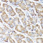 Nrf2 Antibody in Immunohistochemistry (Paraffin) (IHC (P))