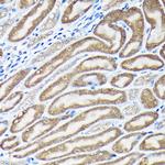 Nrf2 Antibody in Immunohistochemistry (Paraffin) (IHC (P))