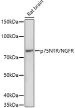 NGF Receptor Antibody in Western Blot (WB)