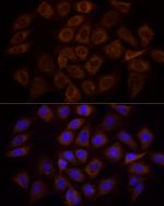 PI3K p85 alpha Antibody in Immunocytochemistry (ICC/IF)