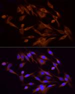 PI3K p85 alpha Antibody in Immunocytochemistry (ICC/IF)