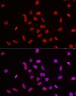 POLR2A Antibody in Immunocytochemistry (ICC/IF)