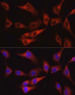 FAK Antibody in Immunocytochemistry (ICC/IF)