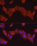 FAK Antibody in Immunocytochemistry (ICC/IF)