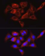 FAK Antibody in Immunocytochemistry (ICC/IF)