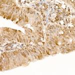 FAK Antibody in Immunohistochemistry (Paraffin) (IHC (P))