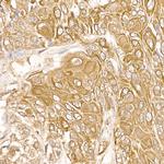 FAK Antibody in Immunohistochemistry (Paraffin) (IHC (P))