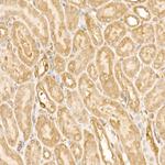 FAK Antibody in Immunohistochemistry (Paraffin) (IHC (P))