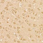 FAK Antibody in Immunohistochemistry (Paraffin) (IHC (P))