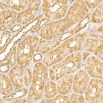 FAK Antibody in Immunohistochemistry (Paraffin) (IHC (P))