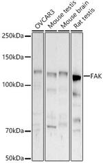 FAK Antibody in Western Blot (WB)