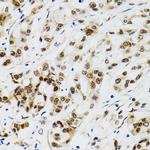 p53 Antibody in Immunohistochemistry (Paraffin) (IHC (P))