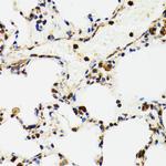 p53 Antibody in Immunohistochemistry (Paraffin) (IHC (P))