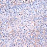 PD-L1 Antibody in Immunohistochemistry (Paraffin) (IHC (P))