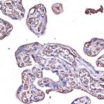 PD-L1 Antibody in Immunohistochemistry (Paraffin) (IHC (P))