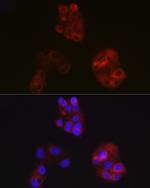 ApoA1 Antibody in Immunocytochemistry (ICC/IF)