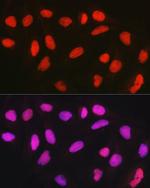 CTCF Antibody in Immunocytochemistry (ICC/IF)