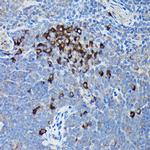 CHOP Antibody in Immunohistochemistry (Paraffin) (IHC (P))