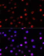 TCF4 Antibody in Immunocytochemistry (ICC/IF)