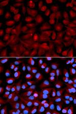 HDAC6 Antibody in Immunocytochemistry (ICC/IF)