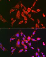 PYCARD Antibody in Immunocytochemistry (ICC/IF)