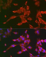 PYCARD Antibody in Immunocytochemistry (ICC/IF)