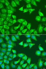 SQSTM1 Antibody in Immunocytochemistry (ICC/IF)