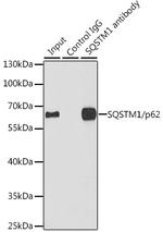 SQSTM1 Antibody in Immunoprecipitation (IP)