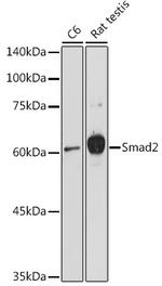 SMAD2 Antibody in Western Blot (WB)