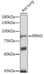 RRM1 Antibody in Western Blot (WB)