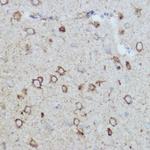 MTCO2 Antibody in Immunohistochemistry (Paraffin) (IHC (P))