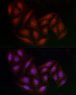 BRCA1 Antibody in Immunocytochemistry (ICC/IF)