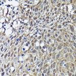 BRCA1 Antibody in Immunohistochemistry (Paraffin) (IHC (P))