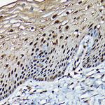 BRCA1 Antibody in Immunohistochemistry (Paraffin) (IHC (P))