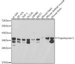 TPM1 Antibody in Western Blot (WB)