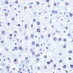 CHD4 Antibody in Immunohistochemistry (Paraffin) (IHC (P))