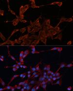 HDJ2 Antibody in Immunocytochemistry (ICC/IF)