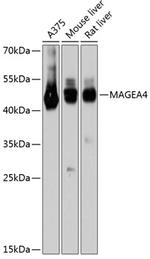 MAGEA4 Antibody in Western Blot (WB)