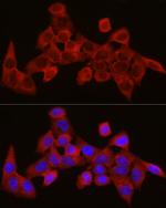 SEC61A1 Antibody in Immunocytochemistry (ICC/IF)