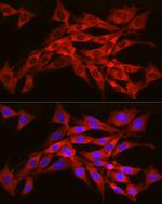 SEC61A1 Antibody in Immunocytochemistry (ICC/IF)