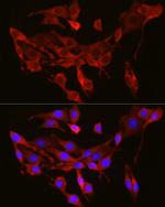 SEC61A1 Antibody in Immunocytochemistry (ICC/IF)